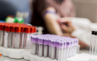 Opt-out HIV Testing 7